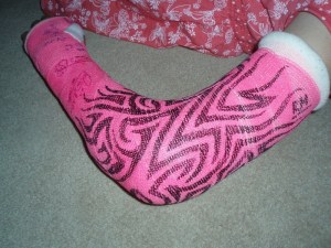 Ellie plaster cast Oct 11th 008